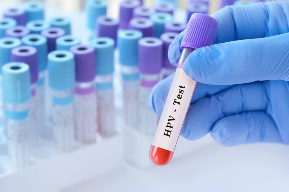 Virus hpv 16 có chữa được không?