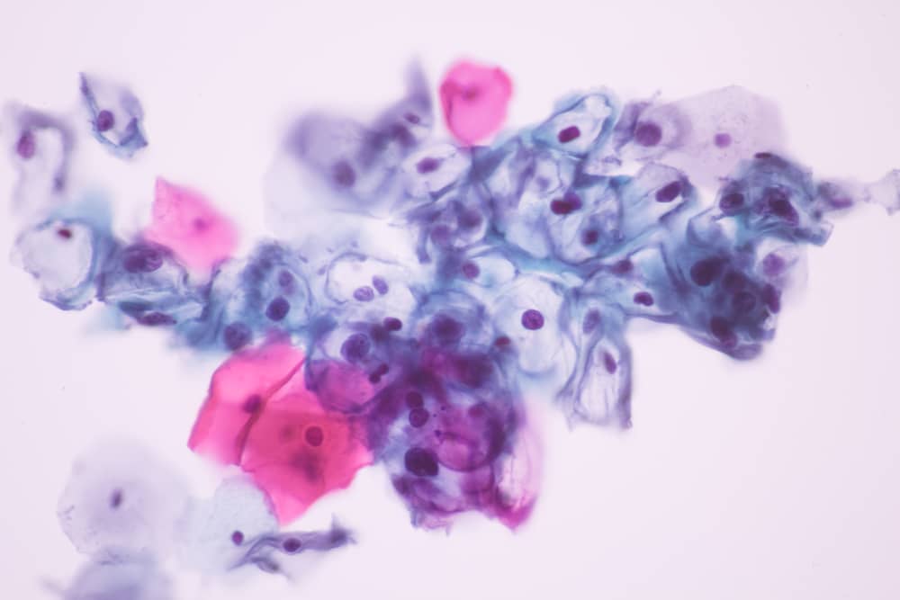 Virus HPV type 52