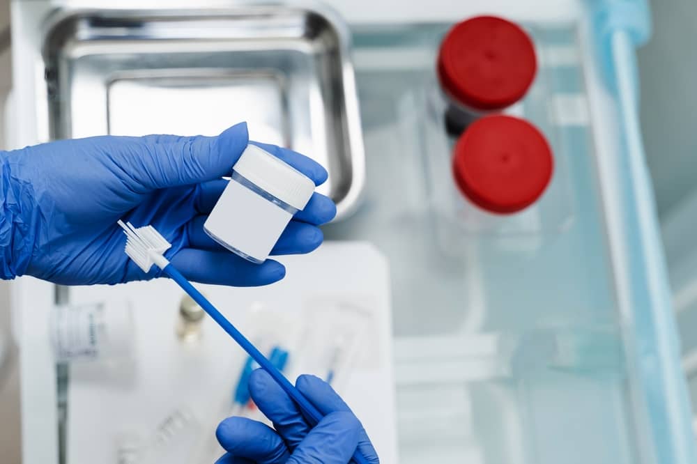 Xét nghiệm Genotype là gì