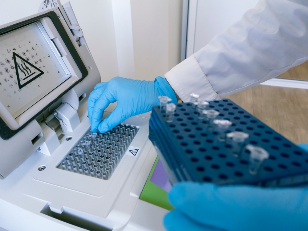 Xét nghiệm HPV bằng real time PCR