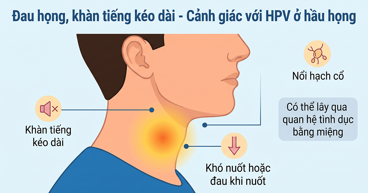 Các dấu hiệu đau họng của hpv