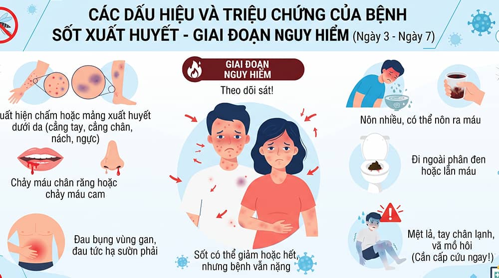 các dấu hiệu bệnh sốt xuất huyết và triệu chứng giai đoạn nguy hiểm