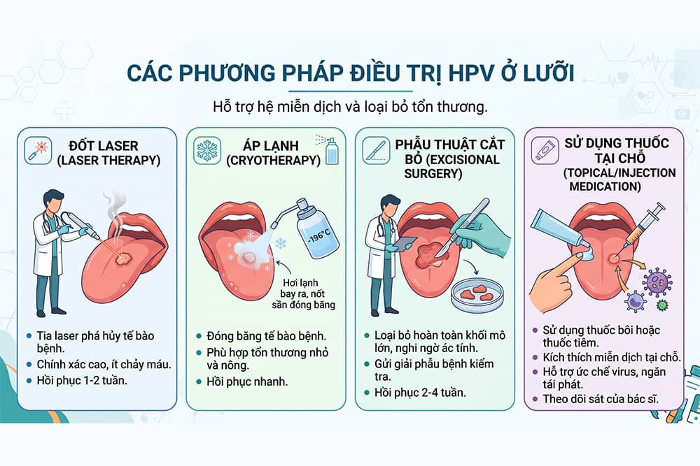 Các phương pháp điều trị HPV ở lưỡi