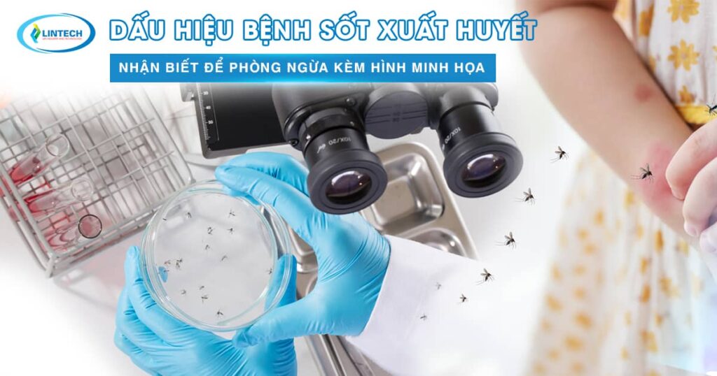 Dấu hiệu nhận biết sốt xuất huyết