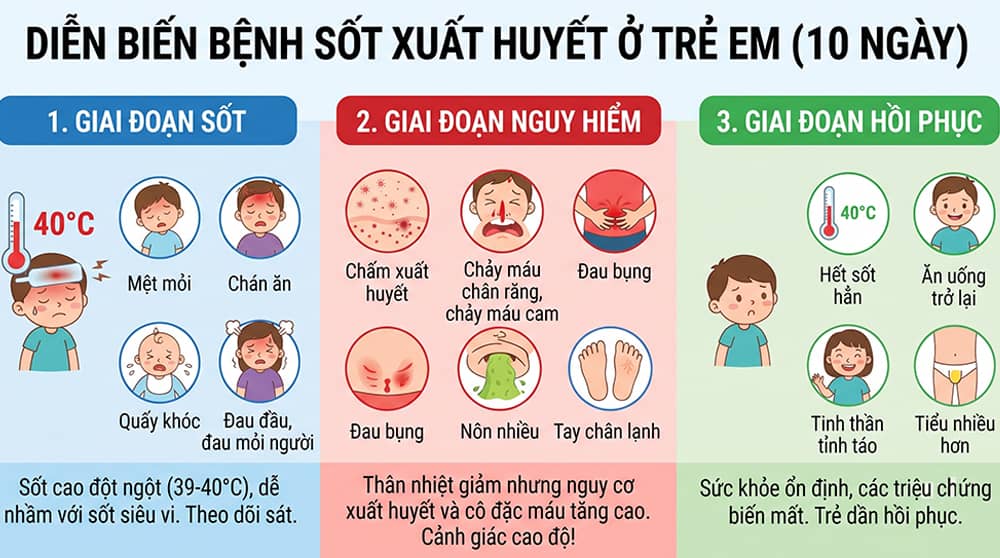 diễn biến bệnh sốt xuất huyết ở trẻ em