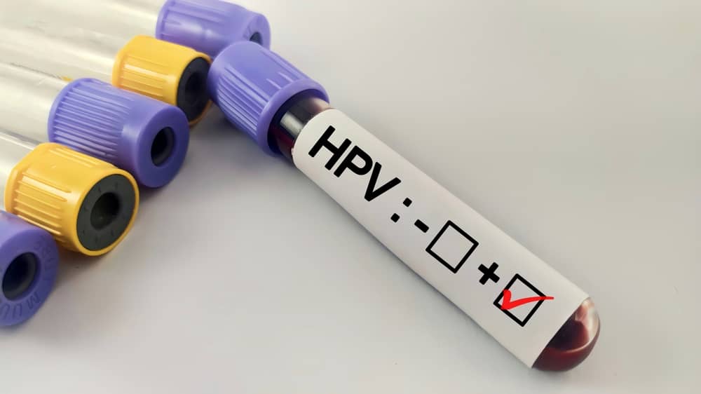 HPV dương tính là gì