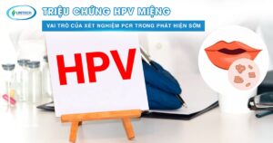 HPV miệng