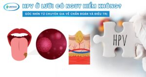 HPV ở lưỡi