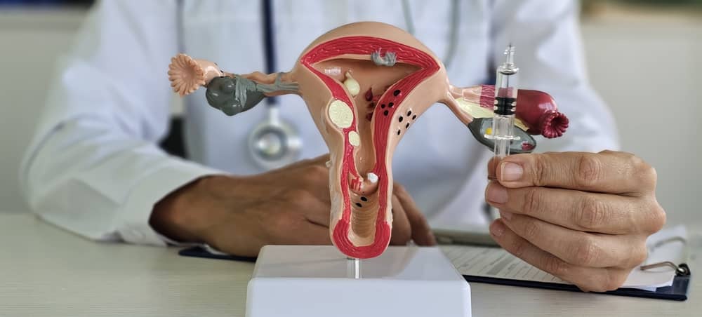 Theo dõi sau phác đồ điều trị HPV