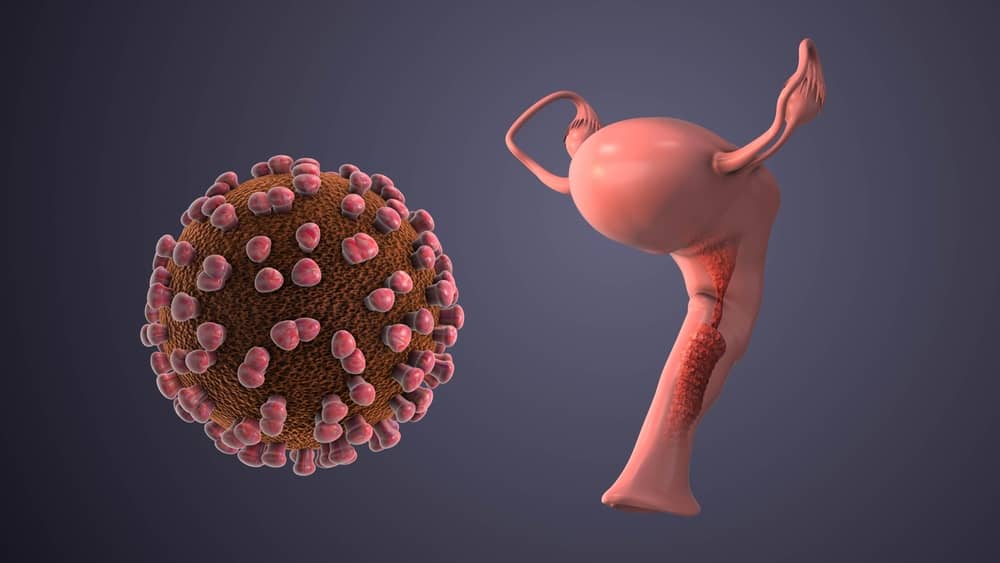 Vì sao cần xét nghiệm để phát hiện HPV sớm?