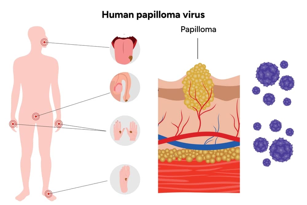 Virus HPV tồn tại ở đâu trong cơ thể người?