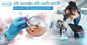 Xét nghiệm sốt xuất huyết bao nhiêu tiền
