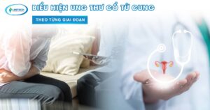 Biểu Hiện Ung Thư Cổ Tử Cung