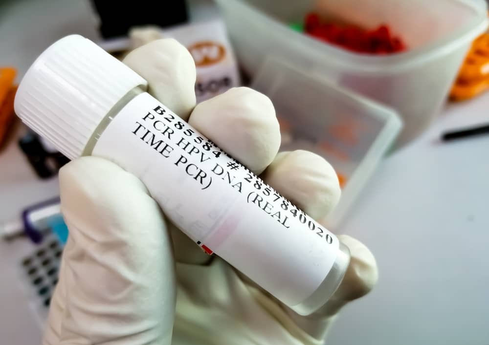 Các Bước Tầm Soát Ung Thư Cổ Tử Cung bằng hệ thống real time PCR