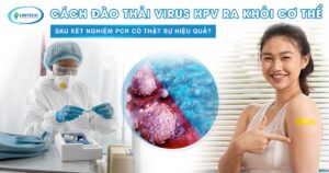 Cách đào thải Virus HPV ra khỏi cơ thể