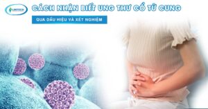 Bác sĩ tư vấn xét nghiệm HPV giúp nhận biết nguy cơ ung thư cổ tử cung