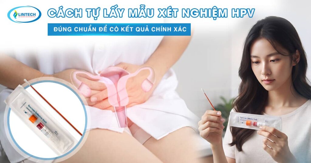 Cách thu mẫu xét nghiệm HPV