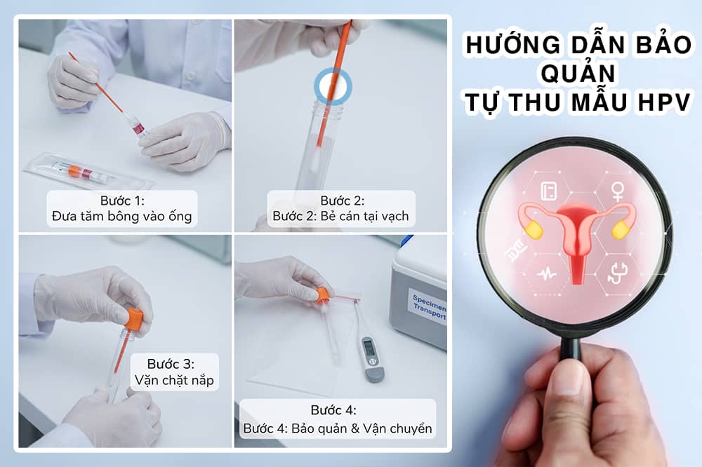Quy trình lấy mẫu từng bước