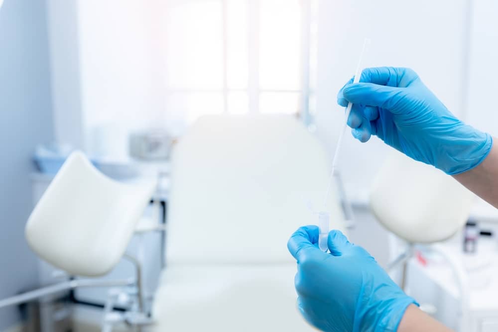 Phương pháp lấy mẫu HPV truyền thống