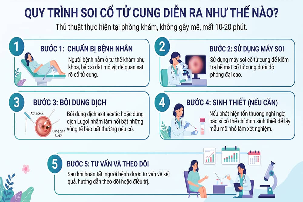 Quy trình soi cổ tử cung diễn ra như thế nào