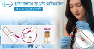 Quy trình tự lấy mẫu HPV