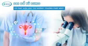 Soi cổ tử cung có phát hiện ung thư không