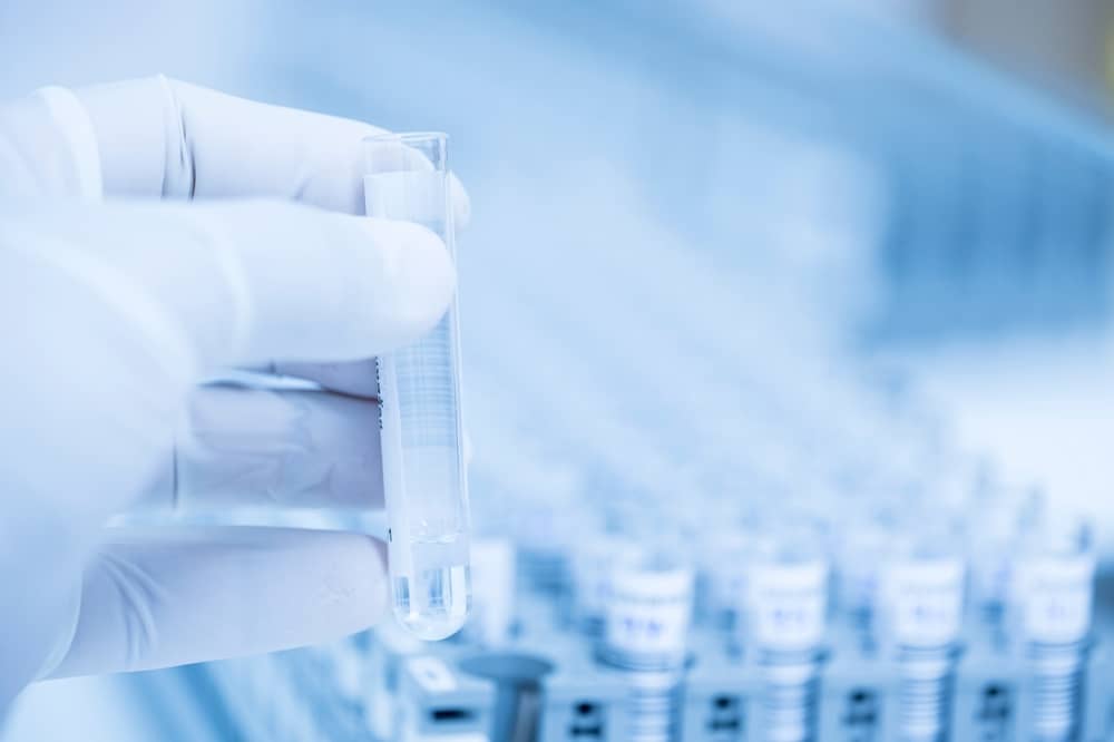 Vì sao cần xét nghiệm định tuýp HPV