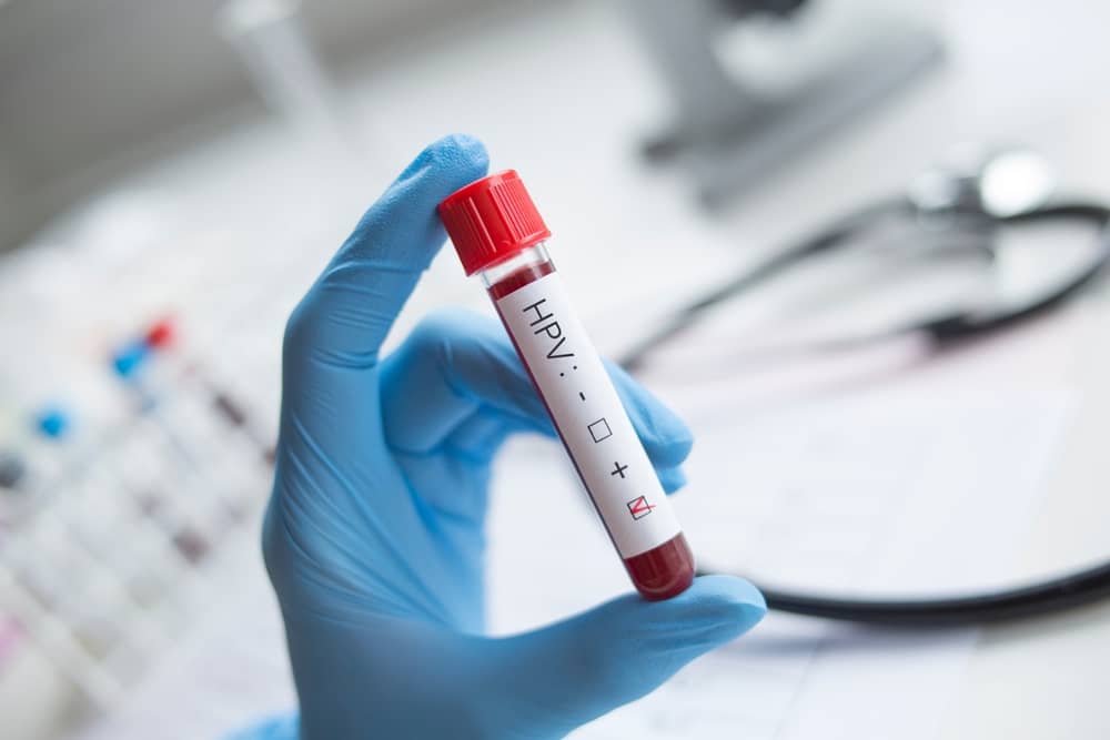 Xét nghiệm máu không thể phát hiện được virus HPV