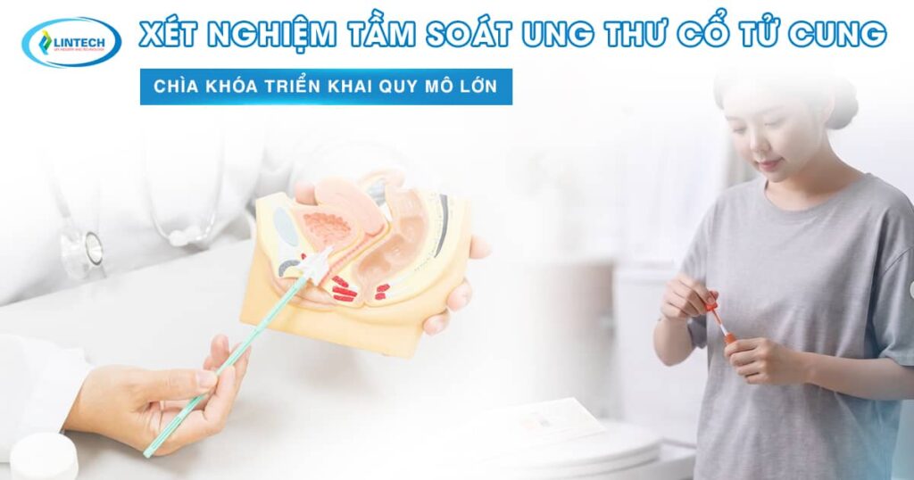Xét nghiệm tầm soát ung thư cổ tử cung