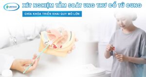 Xét nghiệm tầm soát ung thư cổ tử cung