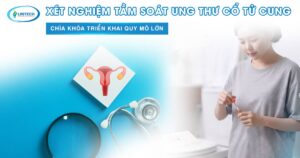 Xét nghiệm tầm soát ung thư cổ tử cung quy mô