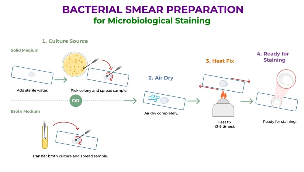Step-by-step bacterial smear preparation from solid and broth culture, air drying and heat fixing a slide before gram staining