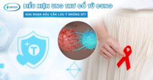 Biểu hiện ung thư cổ tử cung giai đoạn đầu