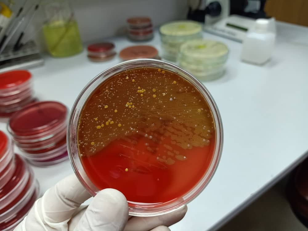Cấu trúc hình thái của gram âm