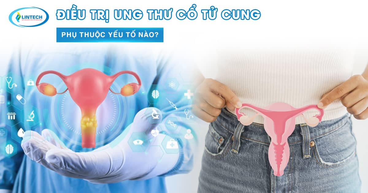Điều trị ung thư cổ tử cung