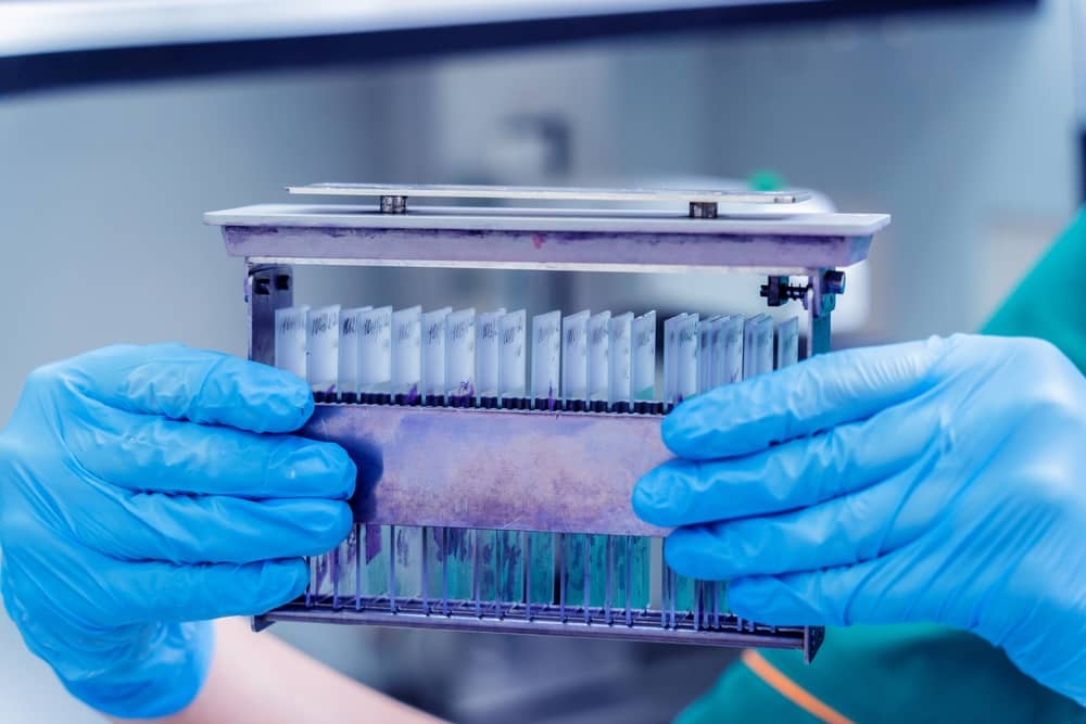 gram stain procedure