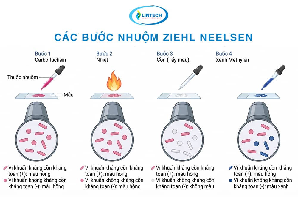 Nguyên lý nhuộm Ziehl Neelsen qua các bước carbol fuchsin nhiệt cồn và xanh methylen
