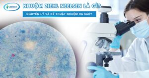 nhuộm Ziehl Neelsen