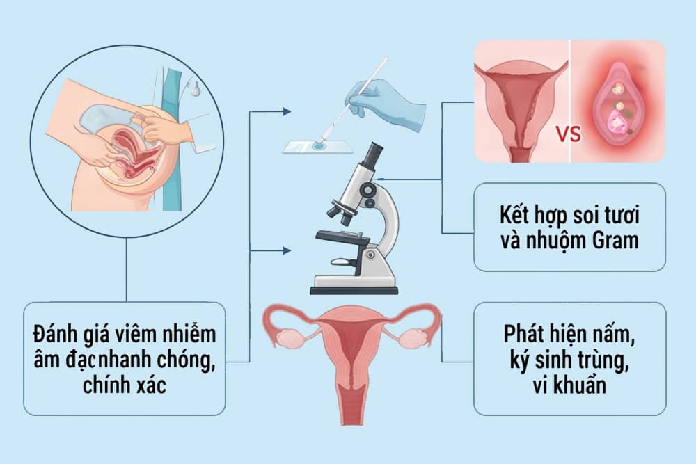 Quá trình soi nhuộm huyết trắng