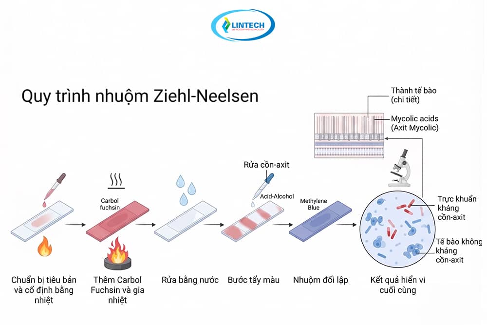 Sơ đồ quy trình nhuộm Ziehl Neelsen chi tiết từ chuẩn bị tiêu bản đến soi kính