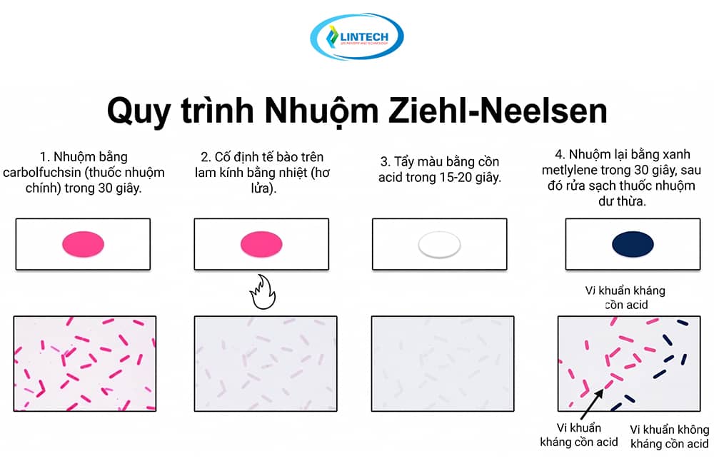 quy trình nhuộm Ziehl Neelsen