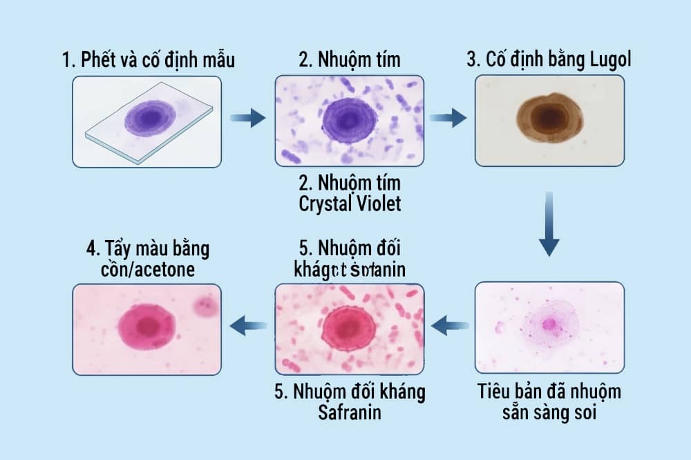Quy trình nhuộm gram