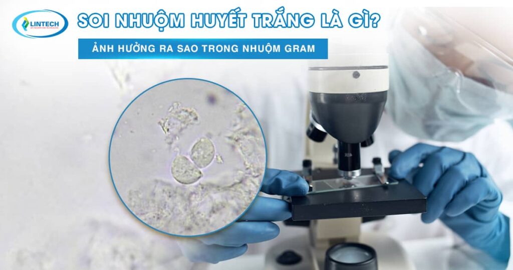 Soi nhuộm huyết trắng