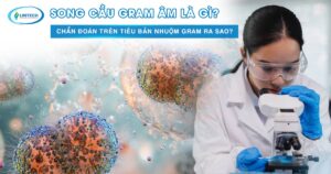 Song cầu gram âm