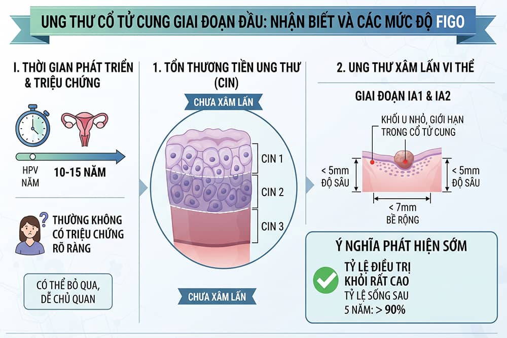 Ung thư cổ tử cung giai đoạn đầu nhận biết mức độ thông qua infographic