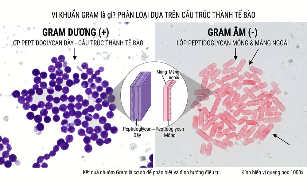 vi khuẩn gram là gì
