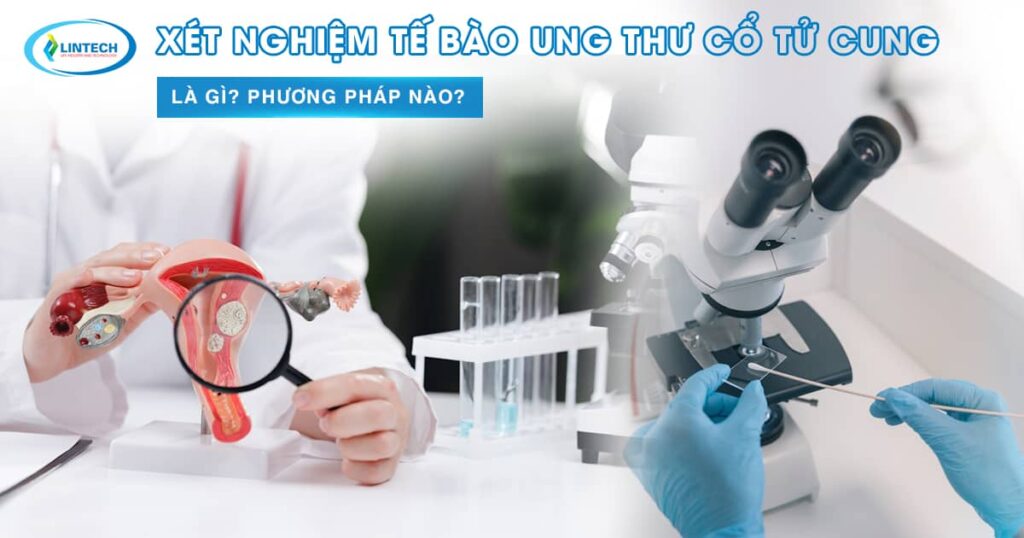Xét nghiệm tế bào ung thư cổ tử cung