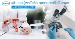 Xét nghiệm tế bào ung thư cổ tử cung