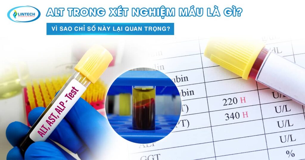 ALT trong xét nghiệm máu