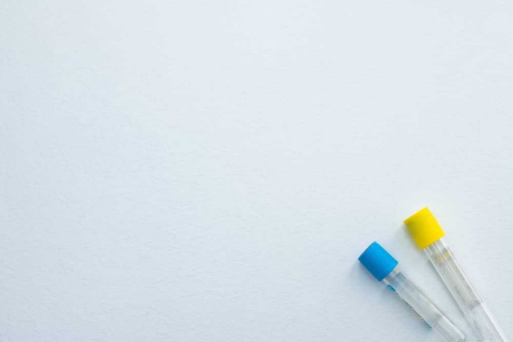 các yếu tố ảnh hưởng đến kết quả xét nghiệm đông máu